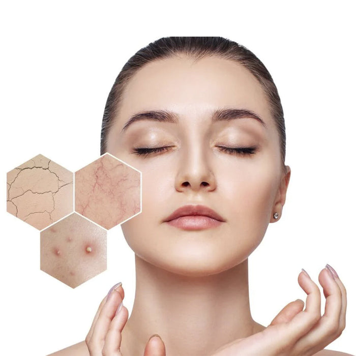 Piel Sensible y Rosácea | Aurea Derma Farmacia - 87f6f8-f3