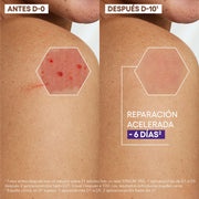 Aderma Epitheliale Ultra Repair, Crema Reparadora Antimarcas 40G