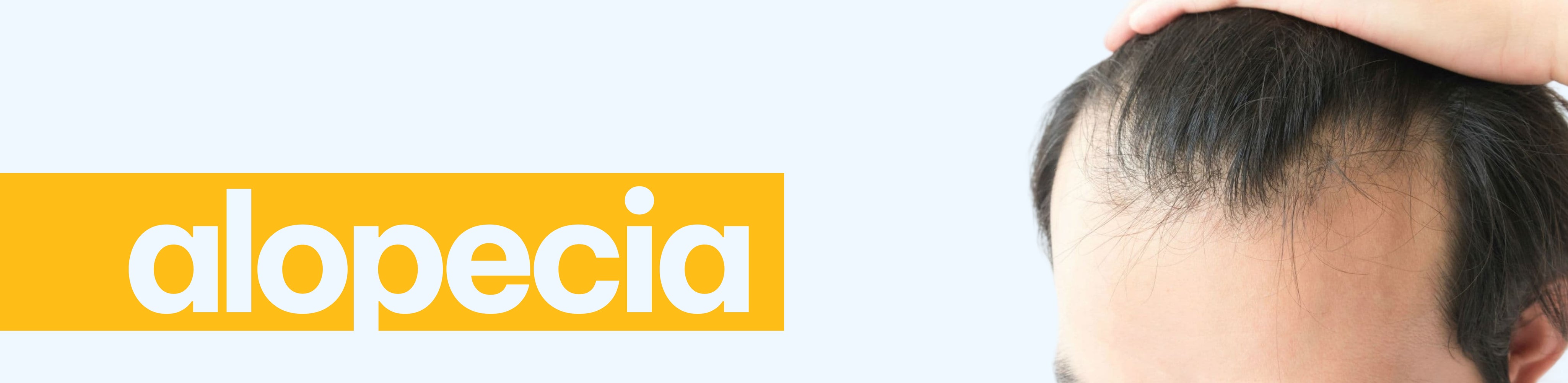 ALOPECIA.jpg