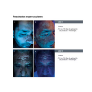 Lullage Repigment12 Tratamiento Para Manchas Blancas 75ml