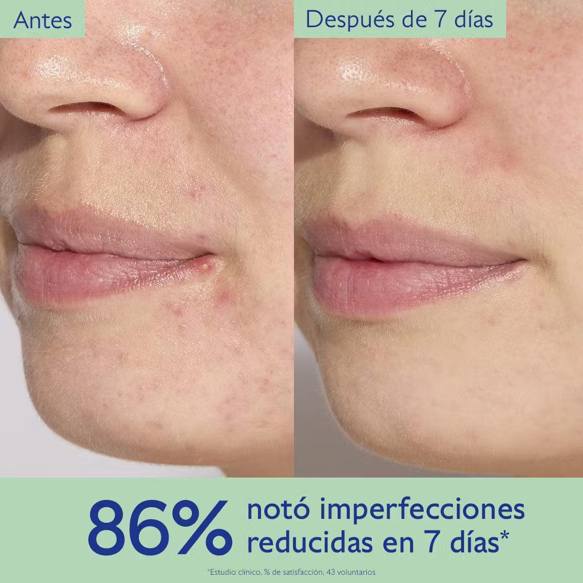 mx-pp-2025-vinopure-serum-2.avif