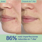 Caudalie Vinopure Serum Tratamiento para el Acné con Ácido Salicílico 30ml